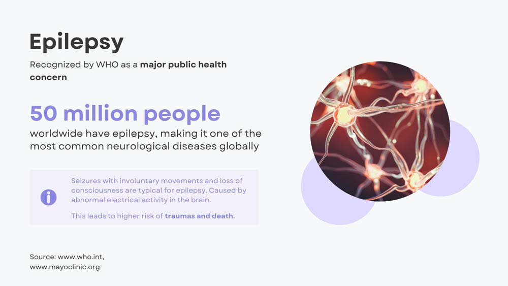 EpiHealth Seizure detection and prediction