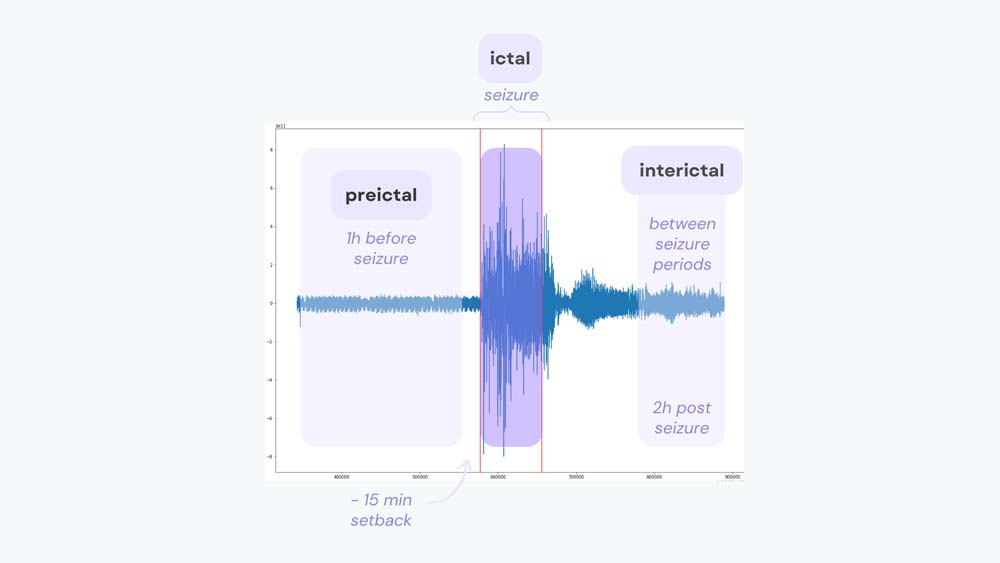 EpiHealth Seizure detection and prediction